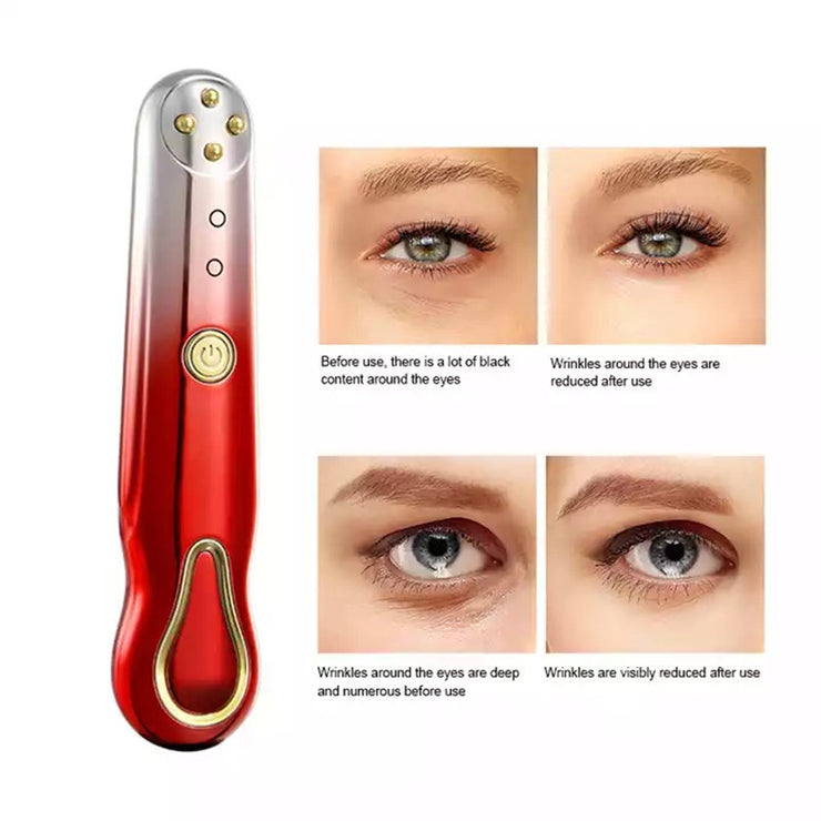 Masseur yeux RF à radiofréquence Anti-rides et anti-cernes portable