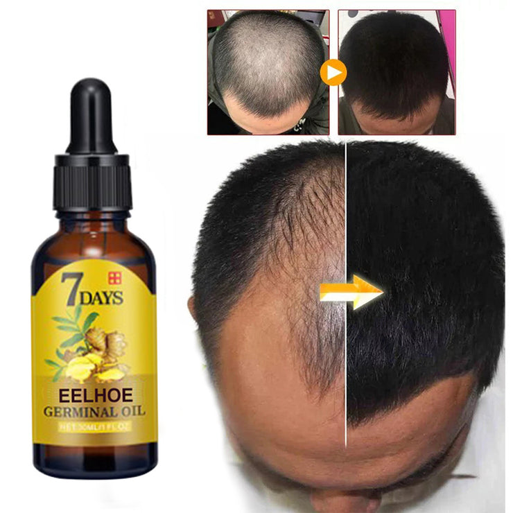 Soin capillaire au gingembre Solution nutritive hydratante anti-chute"